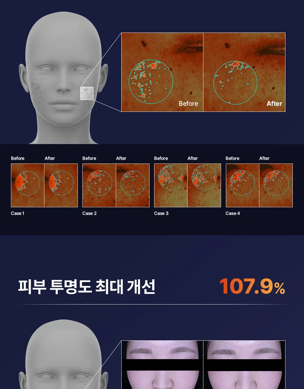 [순수비타민C/잡티앰플] 마미케어 오쏘타민 비타민C 앰플 15ml 상세페이지 27